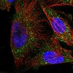 METTL6 Polyclonal Antibody