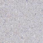 RAB17 Antibody in Immunohistochemistry (Paraffin) (IHC (P))