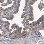 RAB17 Antibody in Immunohistochemistry (Paraffin) (IHC (P))