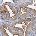 RAB17 Polyclonal Antibody