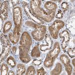 RAB17 Antibody in Immunohistochemistry (Paraffin) (IHC (P))