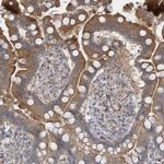 RAB17 Antibody in Immunohistochemistry (Paraffin) (IHC (P))