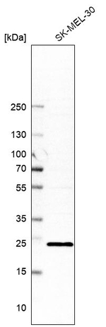 RAB17 Antibody in Western Blot (WB)