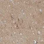 SLC38A2 Antibody in Immunohistochemistry (Paraffin) (IHC (P))