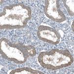 SLC38A2 Antibody in Immunohistochemistry (Paraffin) (IHC (P))