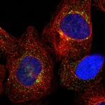 TMEM87B Polyclonal Antibody