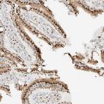 TMEM87B Antibody in Immunohistochemistry (Paraffin) (IHC (P))