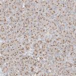 TMEM87B Antibody in Immunohistochemistry (Paraffin) (IHC (P))