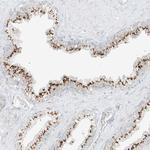 TMEM87B Antibody in Immunohistochemistry (Paraffin) (IHC (P))