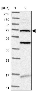 TMEM87B Antibody in Western Blot (WB)