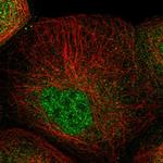 ZNF641 Polyclonal Antibody