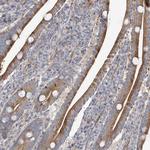 ZNF641 Antibody in Immunohistochemistry (Paraffin) (IHC (P))