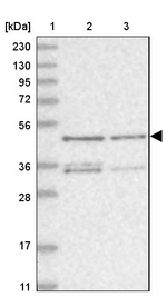 ZNF641 Antibody in Western Blot (WB)