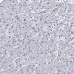 GSTM3 Antibody in Immunohistochemistry (Paraffin) (IHC (P))