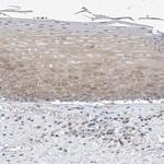 THADA Polyclonal Antibody