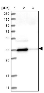 NAGK Antibody in Western Blot (WB)