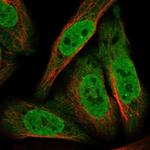 ANKZF1 Polyclonal Antibody