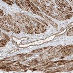 ANKZF1 Antibody in Immunohistochemistry (Paraffin) (IHC (P))
