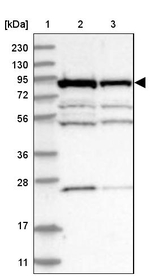 ANKZF1 Antibody in Western Blot (WB)