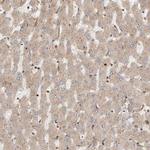 COLEC11 Antibody in Immunohistochemistry (IHC)