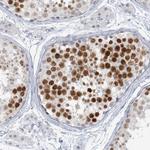 SCML1 Antibody in Immunohistochemistry (Paraffin) (IHC (P))