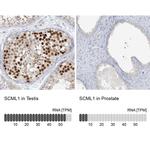 SCML1 Antibody in Immunohistochemistry (IHC)