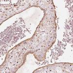GRASP55 Antibody in Immunohistochemistry (IHC)