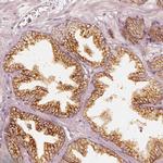 GRASP55 Antibody in Immunohistochemistry (IHC)