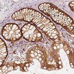 GRASP55 Antibody in Immunohistochemistry (IHC)