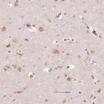 GRASP55 Antibody in Immunohistochemistry (Paraffin) (IHC (P))