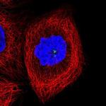 CCDC14 Polyclonal Antibody