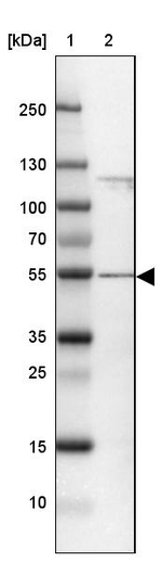 CCDC14 Antibody in Western Blot (WB)