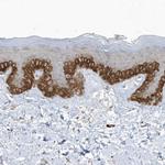 PARD3B Antibody in Immunohistochemistry (Paraffin) (IHC (P))