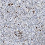DPH3 Antibody in Immunohistochemistry (Paraffin) (IHC (P))