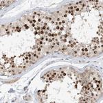 ACYP2 Antibody in Immunohistochemistry (Paraffin) (IHC (P))