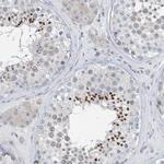 BTBD8 Polyclonal Antibody