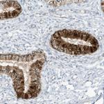 SCGB1D2 Polyclonal Antibody