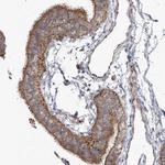 SCGB1D2 Antibody in Immunohistochemistry (Paraffin) (IHC (P))
