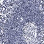 SCGB1D2 Antibody in Immunohistochemistry (Paraffin) (IHC (P))