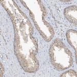 SCGB1D2 Antibody in Immunohistochemistry (Paraffin) (IHC (P))