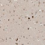 MXI1 Antibody in Immunohistochemistry (IHC)