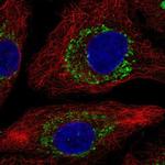 ZBTB3 Polyclonal Antibody