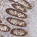 ZBTB3 Antibody in Immunohistochemistry (Paraffin) (IHC (P))