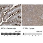 ZBTB3 Polyclonal Antibody