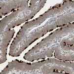 ZBTB3 Antibody in Immunohistochemistry (IHC)
