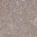 ZBTB3 Antibody in Immunohistochemistry (IHC)