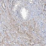 CACNB2 Polyclonal Antibody