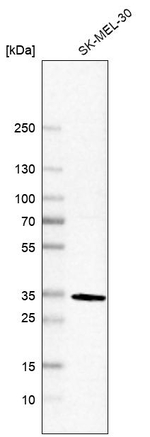Annexin V Antibody in Western Blot (WB)