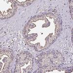 Annexin V Antibody in Immunohistochemistry (IHC)