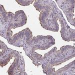 Annexin V Antibody in Immunohistochemistry (IHC)